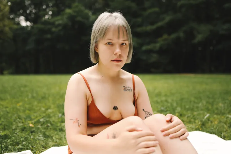 Marked: Fashion's Radical New Love Affair with the Skin You're Actually In